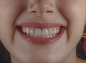 a close up of a person's mouth and gums