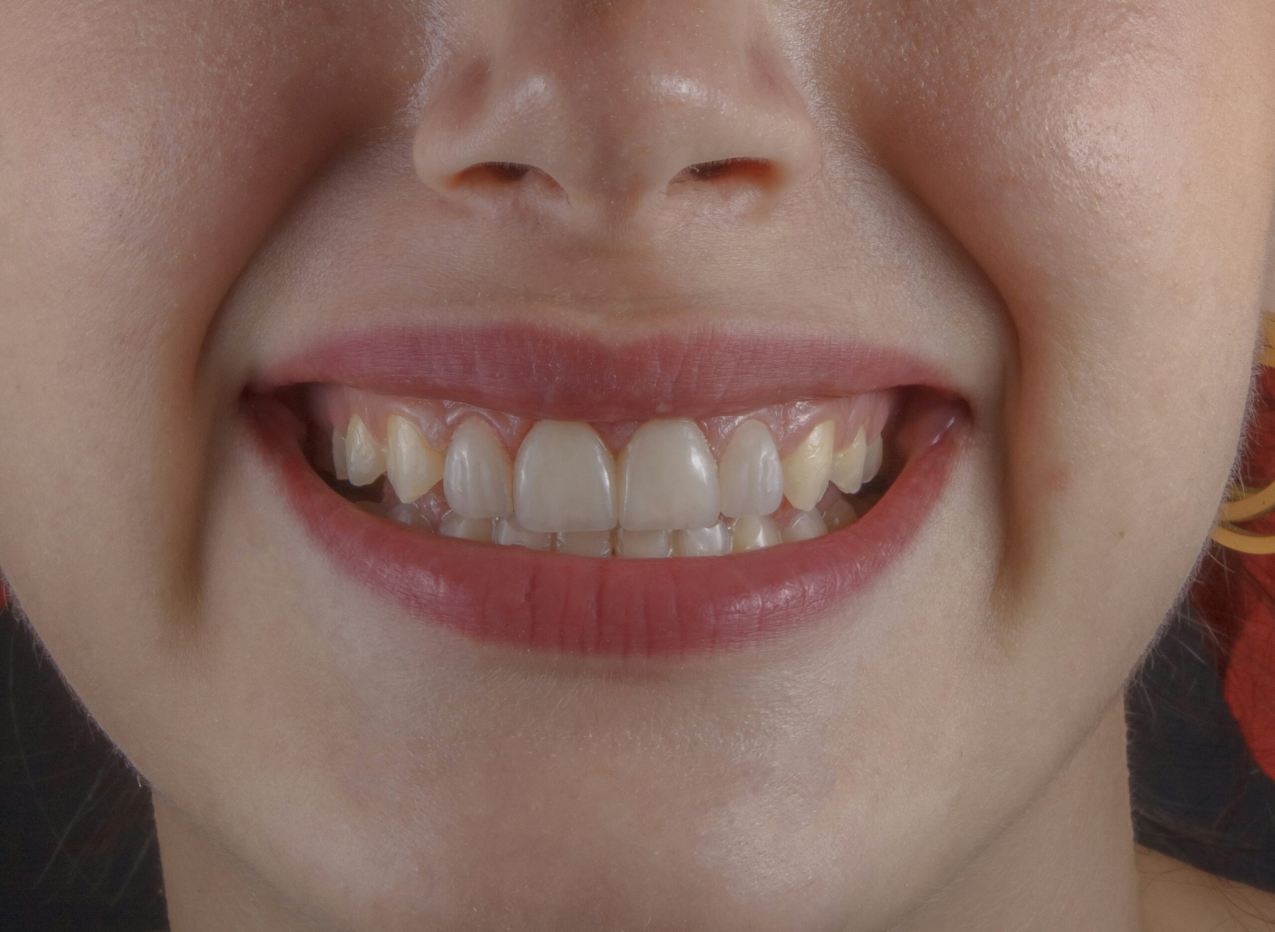 a close up of a person's mouth and gums